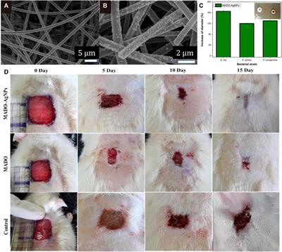 Green synthesis of silver nanoparticles and their antibacterial effects